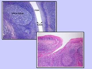 TEJIDO LINFATICO - SESION 6.pptx