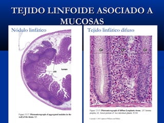 TEJIDO LINFOIDE ASOCIADO A
MUCOSAS
Nódulo linfático

Tejido linfático difuso

 