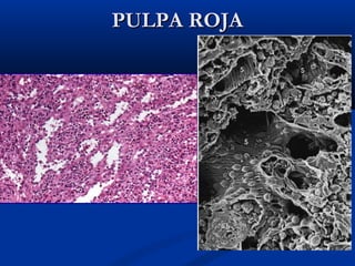 PULPA ROJA

 