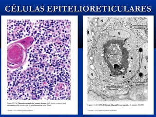 CÉLULAS EPITELIORETICULARES

 