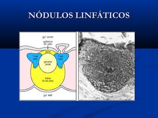 NÓDULOS LINFÁTICOS

 