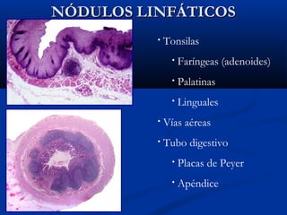 NÓDULOS LINFÁTICOS
•

Tonsilas
•

Faríngeas (adenoides)

•

Palatinas

•

Linguales

•

Vías aéreas

•

Tubo digestivo
•

Placas de Peyer

•

Apéndice

 