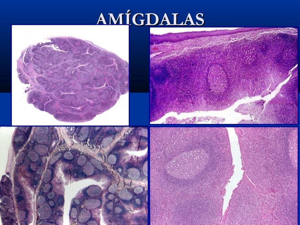 Histología de tejido linfoide