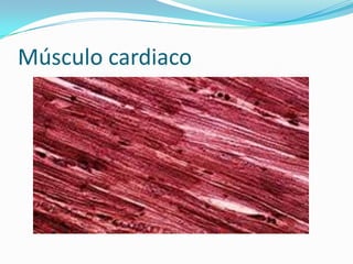 Músculo cardiaco
 