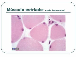 Tejido muscular