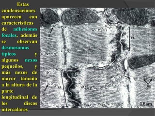 EstasEstas
condensacionescondensaciones
aparecen conaparecen con
característicascaracterísticas
dede adhesionesadhesiones
focalesfocales, además, además
se observanse observan
desmosomasdesmosomas
típicostípicos yy
algunosalgunos nexosnexos
pequeños, ypequeños, y
más nexos demás nexos de
mayor tamañomayor tamaño
a la altura de laa la altura de la
parteparte
longitudinal delongitudinal de
los discoslos discos
intercalaresintercalares
 