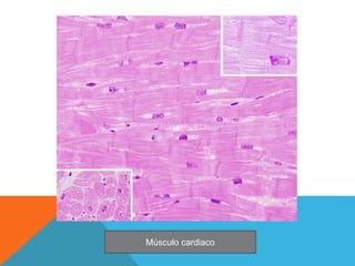 Músculo cardiaco
 