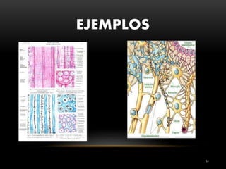 EJEMPLOS
14
 
