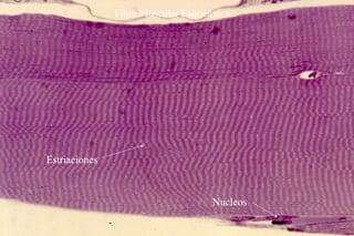 Fibra Muscular Esqueletica
Estriaciones
Nucleos
 