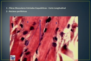 1 - Fibras Musculares Estriadas Esqueléticas - Corte Longitudinal
2 - Núcleos periféricos
 