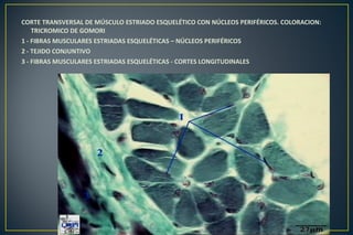 CORTE TRANSVERSAL DE MÚSCULO ESTRIADO ESQUELÉTICO CON NÚCLEOS PERIFÉRICOS. COLORACION:
TRICROMICO DE GOMORI
1 - FIBRAS MUSCULARES ESTRIADAS ESQUELÉTICAS – NÚCLEOS PERIFÉRICOS
2 - TEJIDO CONJUNTIVO
3 - FIBRAS MUSCULARES ESTRIADAS ESQUELÉTICAS - CORTES LONGITUDINALES
 