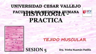 HISTOLOGIA -
PRACTICA
Dra. Yrinha Huamán Padilla
UNIVERSIDAD CESAR VALLEJO
FACULTAD DE MEDICINA HUMANA
SESION 5
TEJIDO MUSCULAR
 