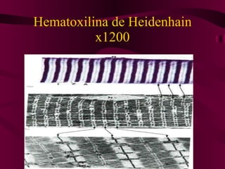 Hematoxilina de Heidenhain x1200 