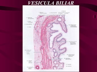 VESICULA BILIAR 
