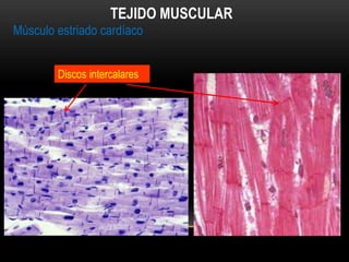 Músculo estriado cardíaco
TEJIDO MUSCULAR
Discos intercalares
 