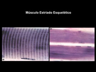 Músculo Estriado Esquelético
 