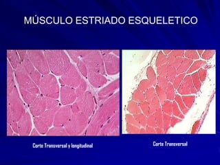 MÚSCULO ESTRIADO ESQUELETICO




 Corte Transversal y longitudinal   Corte Transversal
 
