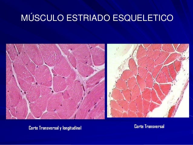 Corte Transversal De Musculo Estriado Esqueletico