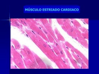 MÚSCULO ESTRIADO CARDIACO
 