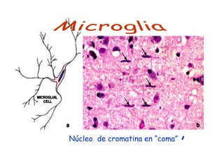 Núcleo de cromatina en “coma”
                                ,
 