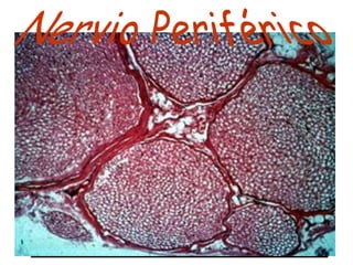 Epineuro


Perineuro



Endoneuro
 