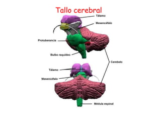 Tallo cerebral
 