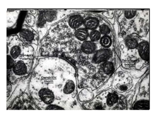 AXO-DENDRÍTICA
                 AXO-SOMÁTICA



                                AXO-AXÓNICA
 