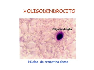 OLIGODENDROCITO




 Núcleo de cromatina densa
 