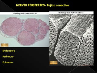 NERVIO PERIFÉRICO- Tejido conectivo




Endoneuro

Perineuro

Epineuro
 