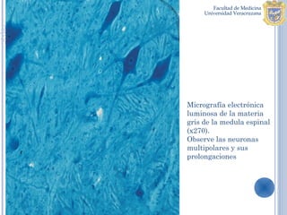 Micrografía electrónica
luminosa de la materia
gris de la medula espinal
(x270).
Observe las neuronas
multipolares y sus
prolongaciones
 