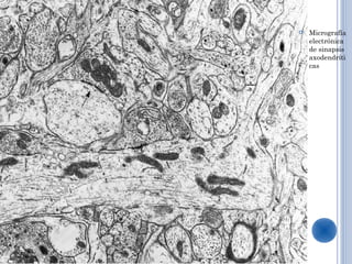    Micrografía
    electrónica
    de sinapsis
    axodendríti
    cas
 