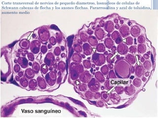 Corte transversal de nervios de pequeño diametroo, losnucleos de celulas de
Schwann cabezas de flecha y los axones flechas. Pararrosalina y azul de toluidina,
aumento medio
 