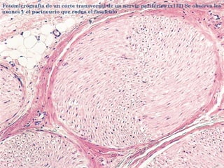 Fotomicrografía de un corte transversal de un nervio periférico (x132) Se observa los
axones y el perineurio que rodea el fascículo
 