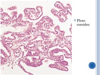    Plexo
    coroideo
 