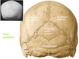 Cara 
posterior 
H. Parietal 
izquierdo. 
Hueso del 
Inca o 
spactal. 
Hueso occipital. 
Porción 
mastoidea 
del Hueso 
Temporal. 
H. Parietal 
derecho. 
