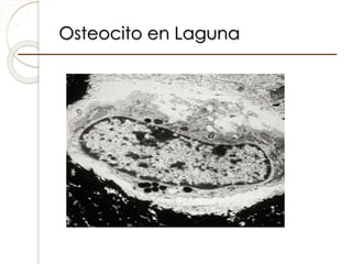 Osteocito en Laguna
 