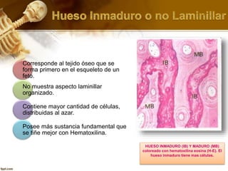 Corresponde al tejido óseo que se
forma primero en el esqueleto de un
feto.
No muestra aspecto laminillar
organizado.
Contiene mayor cantidad de células,
distribuidas al azar.
Posee más sustancia fundamental que
se tiñe mejor con Hematoxilina.
HUESO INMADURO (IB) Y MADURO (MB)
coloreado con hematoxilina eosina (H-E). El
hueso inmaduro tiene mas células.
 