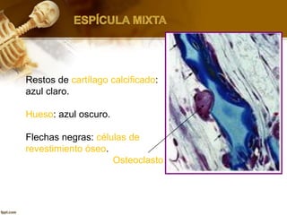 Restos de cartílago calcificado:
azul claro.
Hueso: azul oscuro.
Flechas negras: células de
revestimiento óseo.
Osteoclasto
 