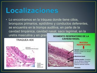 • Lo encontramos en la tráquea donde tiene cilios,
bronquios primarios, epidídimo y conductos deferentes,
se encuentra en la trompa auditiva, en parte de la
cavidad timpánica, cavidad nasal, saco lagrimal, en la
uretra masculina y en grandes conductos excretorios
 