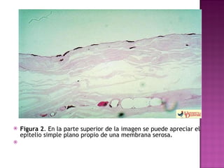 Figura 2 . En la parte superior de la imagen se puede apreciar el epitelio simple plano propio de una membrana serosa.   