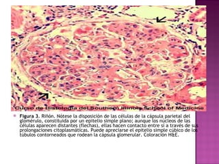 Figura 3 . Riñón. Nótese la disposición de las células de la cápsula parietal del glomérulo, constituida por un epitelio simple plano; aunque los núcleos de las células aparecen distantes (flechas), ellas hacen contacto entre sí a través de sus prolongaciones citoplasmáticas. Puede apreciarse el epitelio simple cúbico de los túbulos contorneados que rodean la cápsula glomerular. Coloración H&E.  