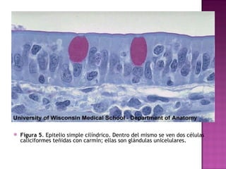 Figura 5 . Epitelio simple cilíndrico. Dentro del mismo se ven dos células caliciformes teñidas con carmín; ellas son glándulas unicelulares. 