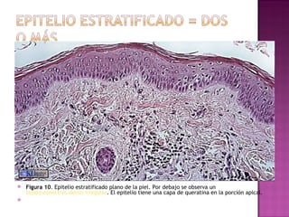 Figura 10 . Epitelio estratificado plano de la piel. Por debajo se observa un  tejido conectivo denso irregular . El epitelio tiene una capa de queratina en la porción apical.   