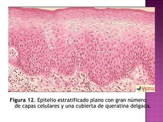 Figura 12 . Epitelio estratificado plano con gran número de capas celulares y una cubierta de queratina delgada. 