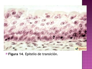 Figura 14 . Epitelio de transición.  