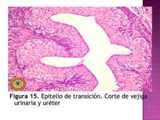 Figura 15 . Epitelio de transición. Corte de vejiga urinaria y uréter  