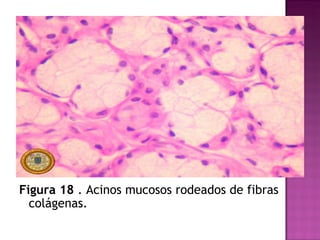 Figura 18  . Acinos mucosos rodeados de fibras colágenas. 