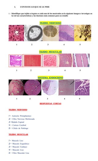 I.       CONTESTE LO QUE SE LE PIDE


I.1 Identifique que tejido u órgano es cada uno de los mostrados en la siguiente imagen e investigue en
   la red sus características y las tinciones más comunes para su estudio


                                      TEJIDO NERVIOSO




            1                 2                3                   4                   5


                                     TEJIDO MUSCULAR




            1              2                       3                4                  5


                                   SISTEMA ENDOCRINO




            1             2                    3                    4                 5

                                      RESPUESTAS CORTAS


TEJIDO NERVIOSO


1.- Astrocito Protoplásmico
2.- Fibra Nerviosa Mielinizada
3.-Medula Espinal
4.- Corteza Cerebral
5.- Célula de Purkinge


TEJIDO MUSCULAR


1.- Musculo Liso
2.- Musculo Esquelético
3.- Musculo Cardiaco
4.- Musculo Liso
5.- Fibra Muscular Lisa
 