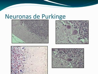 Neuronas de Purkinge 5 5 5 click para ampliar 