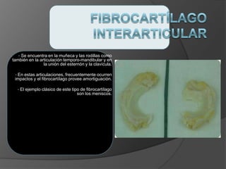 • Se encuentra en la muñeca y las rodillas como
también en la articulación temporo-mandibular y en
la unión del esternón y la clavícula.
• En estas articulaciones, frecuentemente ocurren
impactos y el fibrocartílago provee amortiguación.
• El ejemplo clásico de este tipo de fibrocartílago
son los meniscos.
 